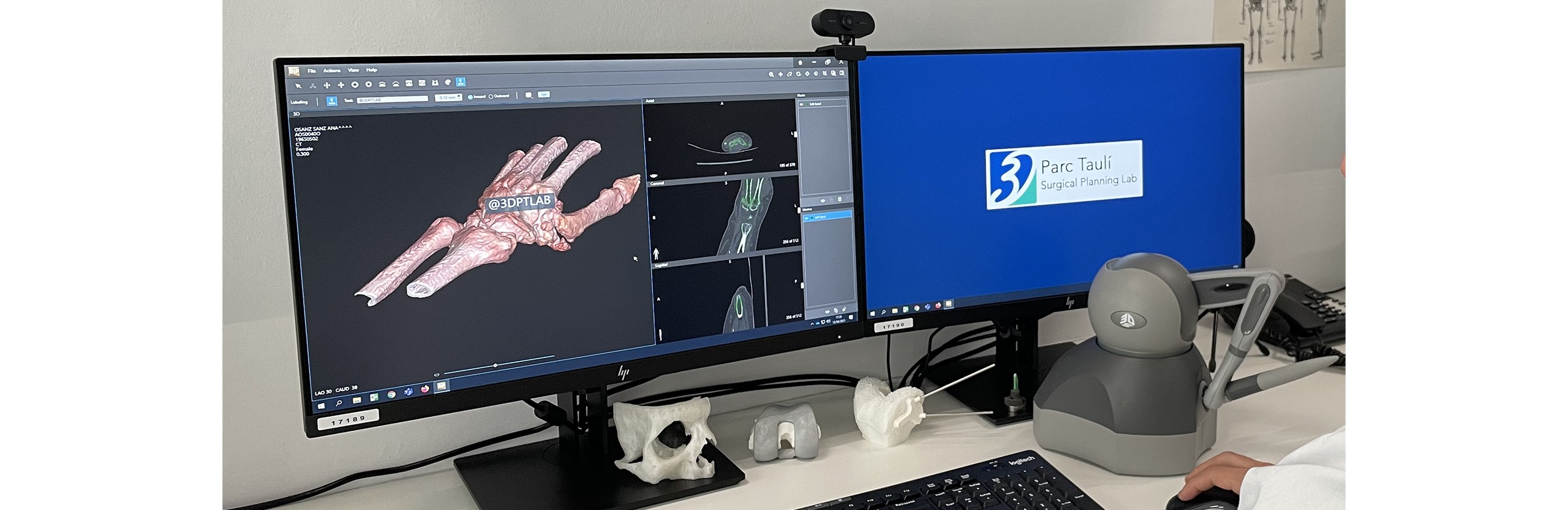Laboratorio 3D del Hospital Parc Taulí de Sabadell