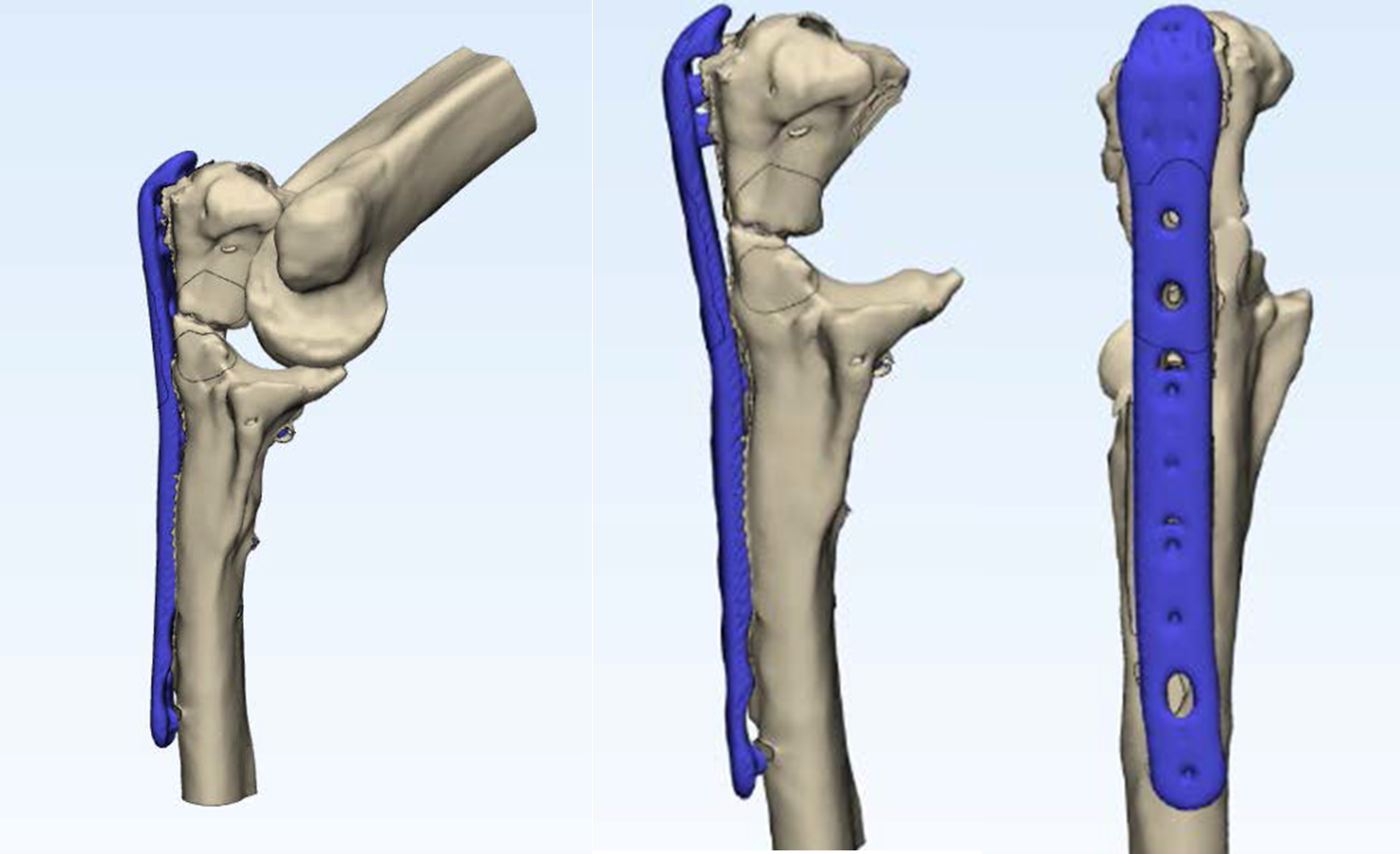 imagen 3D codo