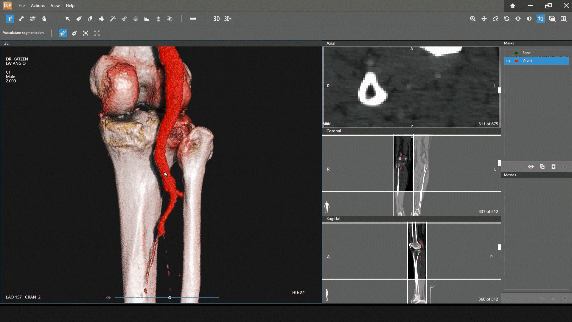 Crea modelos digitales 3D con calidad de diagnóstico