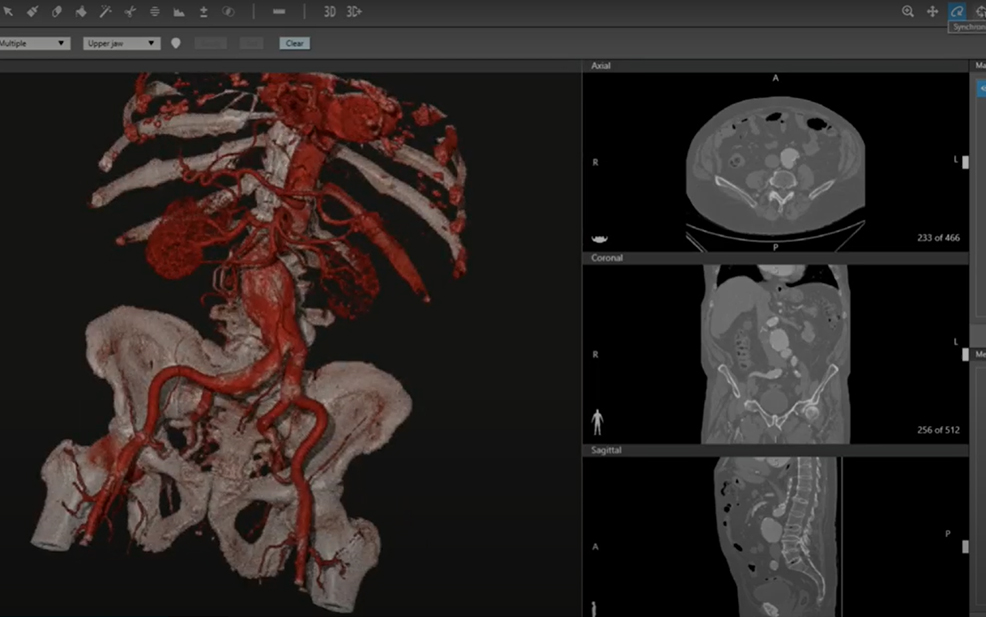 Avanzado: Vascular, Realidad virtual y Diseño 3D