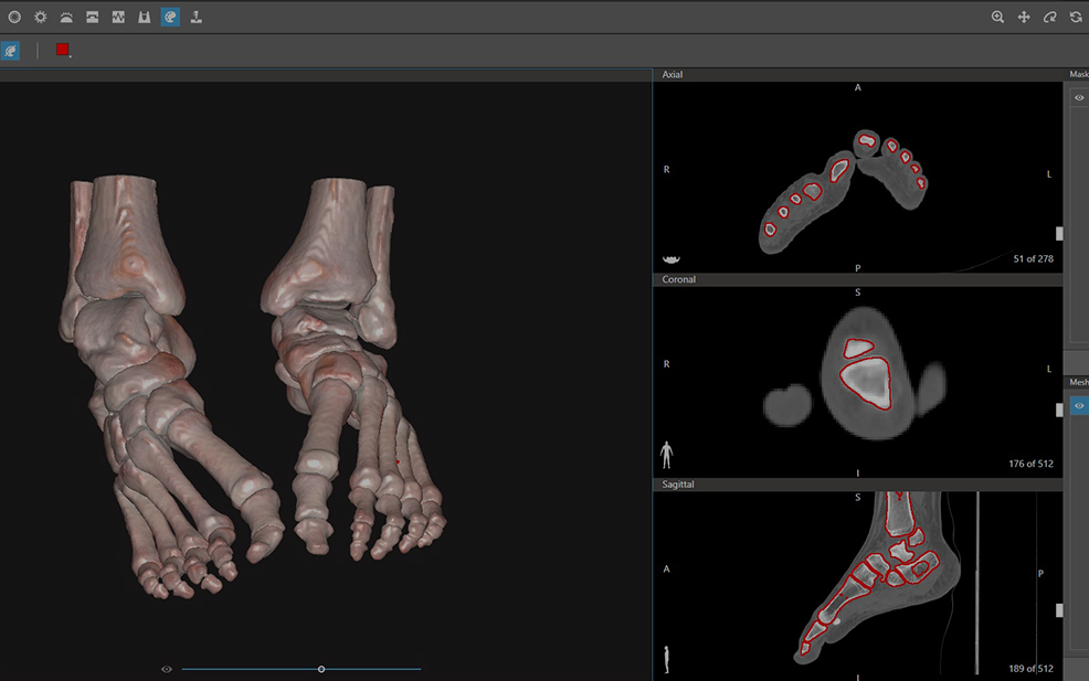 Iniciación: Optimizado para traumatología